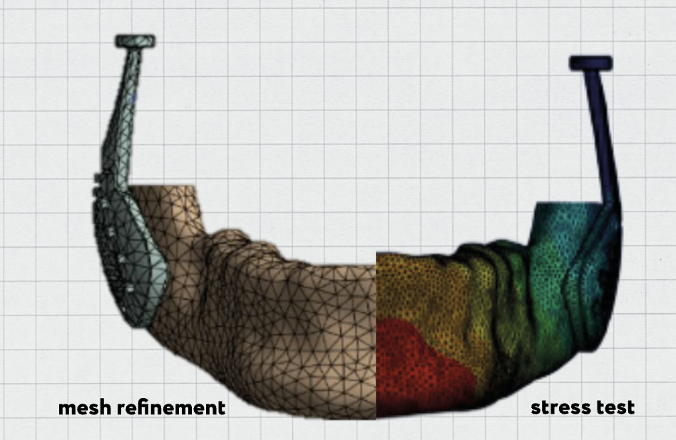 mandible fea analysis showing mesh refinement on left and stress heatmap on right